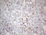 APOB48R Antibody in Immunohistochemistry (Paraffin) (IHC (P))