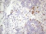 APOB48R Antibody in Immunohistochemistry (Paraffin) (IHC (P))