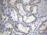 CD248 Antibody in Immunohistochemistry (Paraffin) (IHC (P))