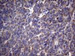PAPSS2 Antibody in Immunohistochemistry (Paraffin) (IHC (P))