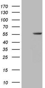 ZNF35 Antibody in Western Blot (WB)