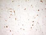Myeloid Specific Antigen Antibody in Immunohistochemistry (Paraffin) (IHC (P))