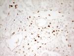 Myeloid Specific Antigen Antibody in Immunohistochemistry (Paraffin) (IHC (P))