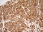 Renin Antibody in Immunohistochemistry (Paraffin) (IHC (P))
