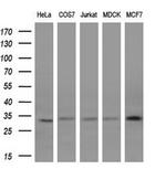 KChIP2 Monoclonal Antibody (OTI3D8)