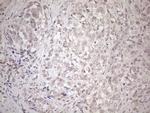 HSF2 Monoclonal Antibody (OTI3E1)