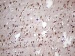 NUP43 Antibody in Immunohistochemistry (Paraffin) (IHC (P))