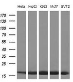 eIF1AY Monoclonal Antibody (OTI2G2)