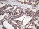 NUP43 Antibody in Immunohistochemistry (Paraffin) (IHC (P))