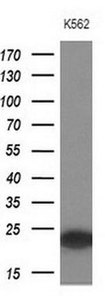 MYL4 Antibody in Western Blot (WB)