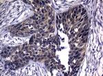 CDCA8 Antibody in Immunohistochemistry (Paraffin) (IHC (P))