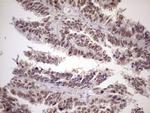ATF1 Antibody in Immunohistochemistry (Paraffin) (IHC (P))