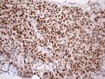 ATF1 Antibody in Immunohistochemistry (Paraffin) (IHC (P))