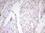 MEF2D Antibody in Immunohistochemistry (Paraffin) (IHC (P))