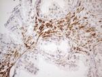 ATF1 Antibody in Immunohistochemistry (Paraffin) (IHC (P))