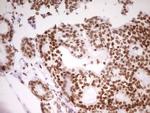 SP110 Antibody in Immunohistochemistry (Paraffin) (IHC (P))
