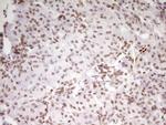 SP110 Antibody in Immunohistochemistry (Paraffin) (IHC (P))