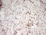 SP110 Antibody in Immunohistochemistry (Paraffin) (IHC (P))