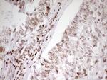 SP110 Antibody in Immunohistochemistry (Paraffin) (IHC (P))
