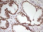 SP110 Antibody in Immunohistochemistry (Paraffin) (IHC (P))