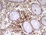 SP110 Antibody in Immunohistochemistry (Paraffin) (IHC (P))