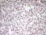 SP110 Antibody in Immunohistochemistry (Paraffin) (IHC (P))