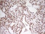 SP110 Antibody in Immunohistochemistry (Paraffin) (IHC (P))