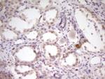 SP110 Antibody in Immunohistochemistry (Paraffin) (IHC (P))