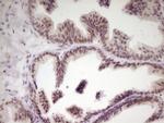SP110 Antibody in Immunohistochemistry (Paraffin) (IHC (P))