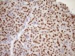 PCQAP Antibody in Immunohistochemistry (Paraffin) (IHC (P))