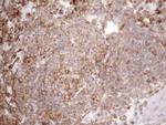 Kindlin 3 Antibody in Immunohistochemistry (Paraffin) (IHC (P))