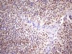 SPT3 Antibody in Immunohistochemistry (Paraffin) (IHC (P))
