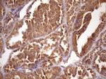 ASB2 Antibody in Immunohistochemistry (Paraffin) (IHC (P))