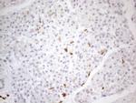 SNRPB2 Antibody in Immunohistochemistry (Paraffin) (IHC (P))
