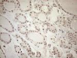 ASB2 Antibody in Immunohistochemistry (Paraffin) (IHC (P))