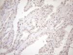ASB2 Antibody in Immunohistochemistry (Paraffin) (IHC (P))