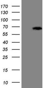 ASB2 Antibody in Western Blot (WB)