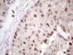 ZNF200 Antibody in Immunohistochemistry (Paraffin) (IHC (P))