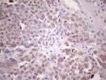 ZNF200 Antibody in Immunohistochemistry (Paraffin) (IHC (P))