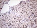 ZNF200 Antibody in Immunohistochemistry (Paraffin) (IHC (P))