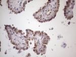 ZNF200 Antibody in Immunohistochemistry (Paraffin) (IHC (P))