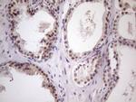 ZNF200 Antibody in Immunohistochemistry (Paraffin) (IHC (P))