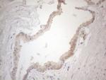 ZNF200 Antibody in Immunohistochemistry (Paraffin) (IHC (P))