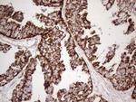 STOML2 Monoclonal Antibody (OTI1G6)