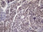 ATP6V1C2 Antibody in Immunohistochemistry (Paraffin) (IHC (P))