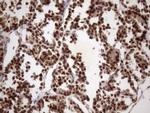 MGC12965 Antibody in Immunohistochemistry (Paraffin) (IHC (P))