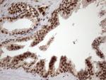 MGC12965 Antibody in Immunohistochemistry (Paraffin) (IHC (P))