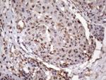 MGC12965 Antibody in Immunohistochemistry (Paraffin) (IHC (P))