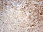 PPA2 Antibody in Immunohistochemistry (Paraffin) (IHC (P))