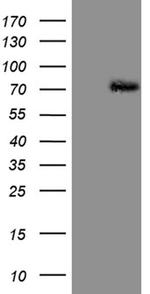 PIAS2 Antibody in Western Blot (WB)